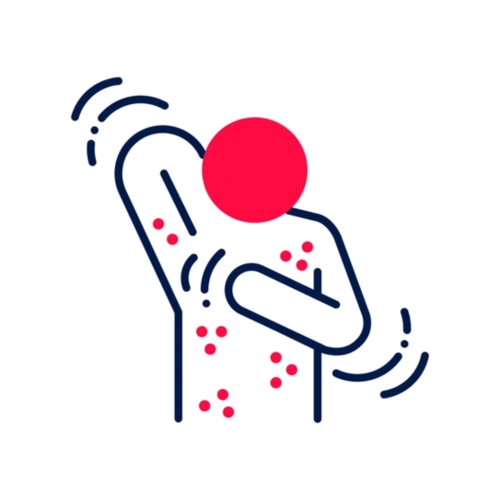 Skin Related Disease