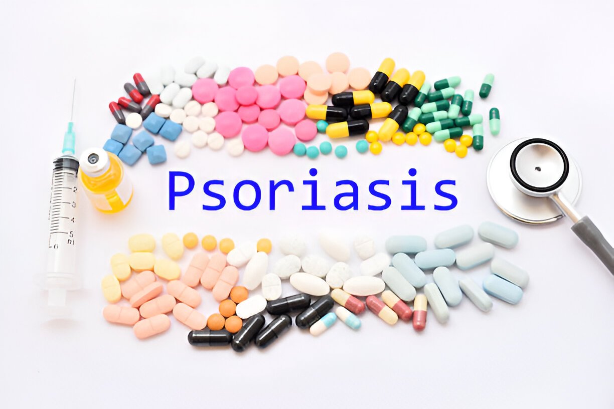 Psoriasis Medicine